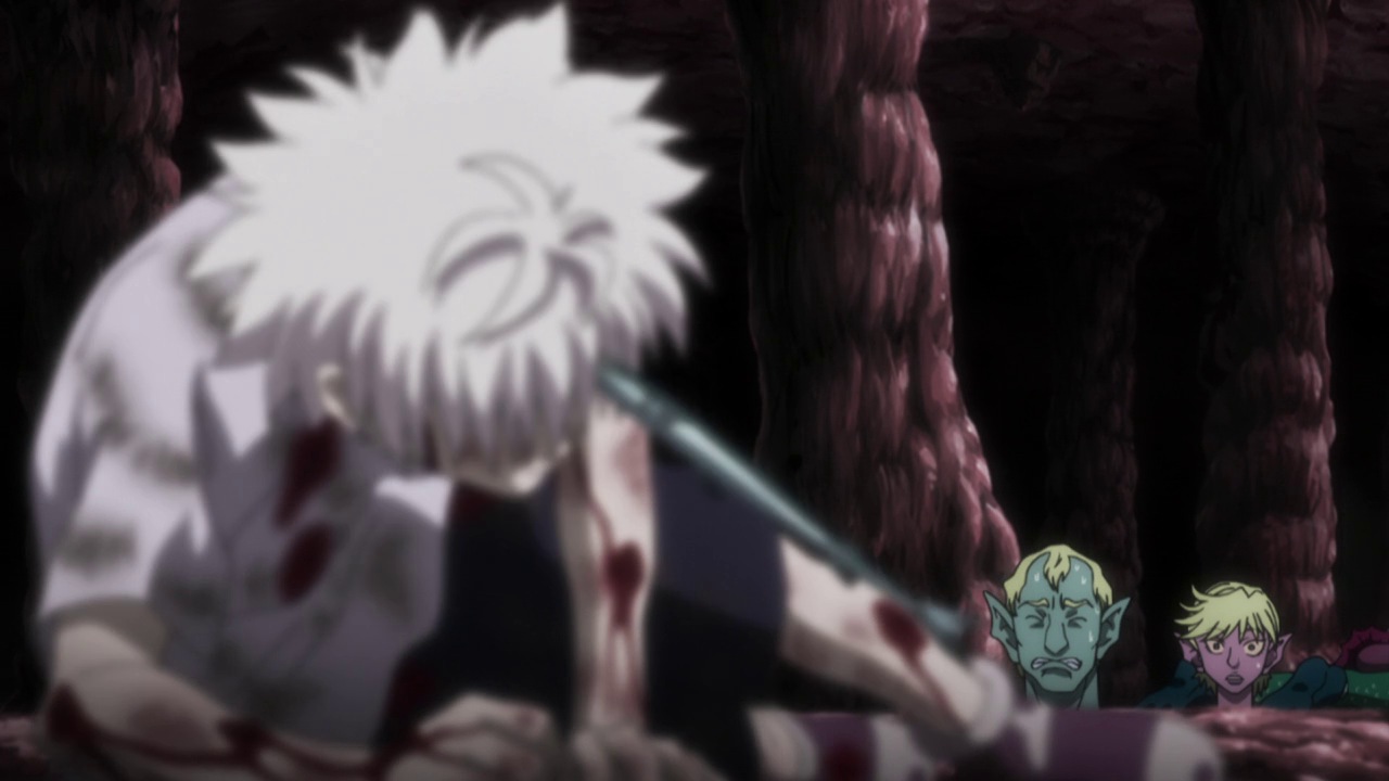 ikalgo e killua